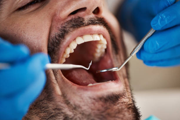 Best Teeth Whitening  in Papillion, NE
