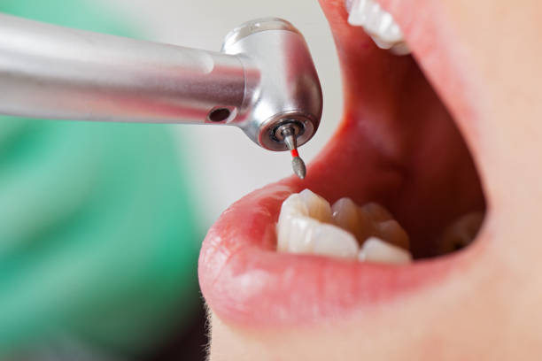 Best Tooth Infection Emergency Dentist  in Papillion, NE